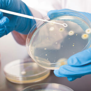 INOCULATION-LOOPS-SPREADERS